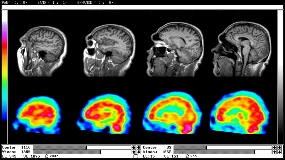 Imagini pentru nuclear medicine