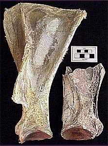 Scapula 